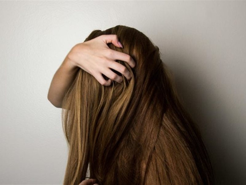 8 علاجات منزلية للتخلص من قشرة الرأس