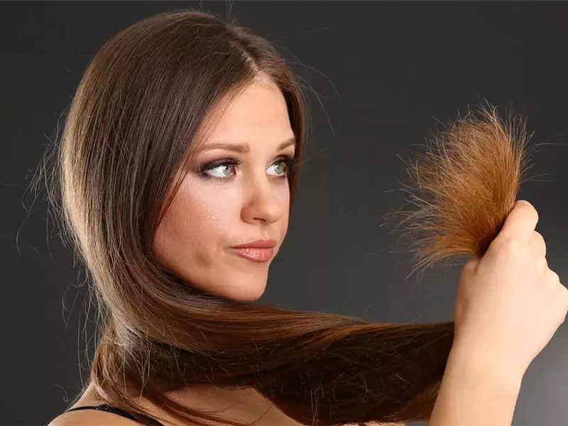 أسباب تقصف الشعر.. تعرف على أنواعه 