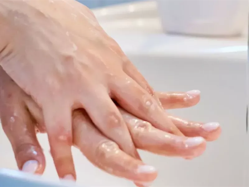 في اليوم العالمي لغسل اليدين.. كيف يساعد في الوقاية من الأمراض؟