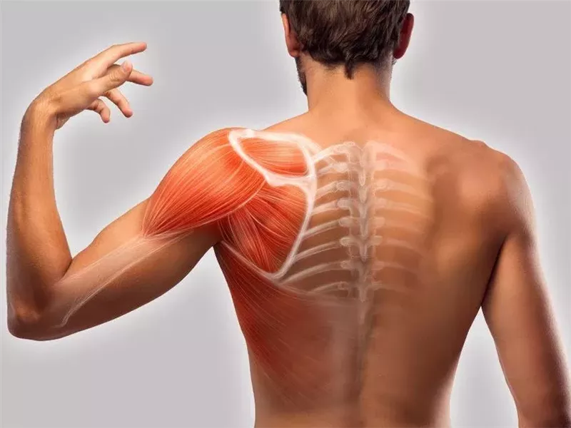 عوامل تزيد فرص الإصابة بالفيبروميالجيا.. هل يمكن الوقاية منها؟ 