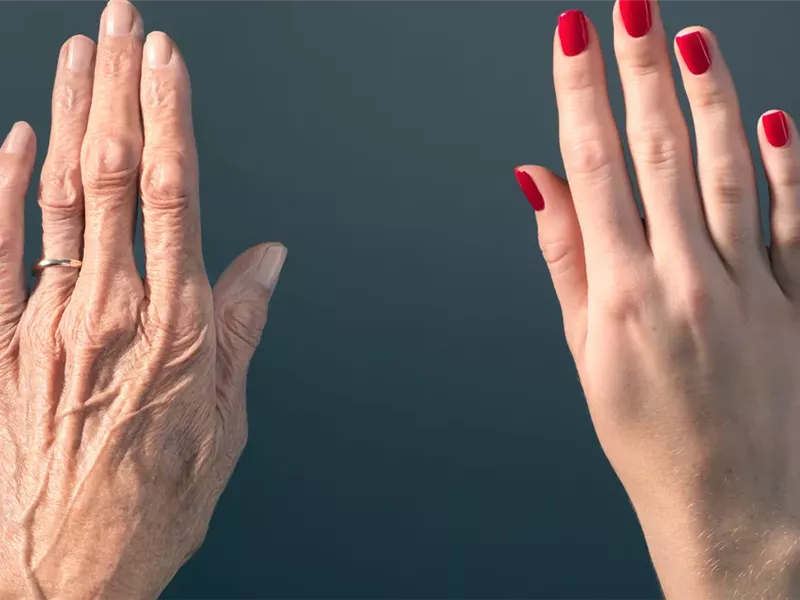 الكولاجين سر نضارة البشرة.. إليك كيفية تعزيزه بشكل طبيعي 