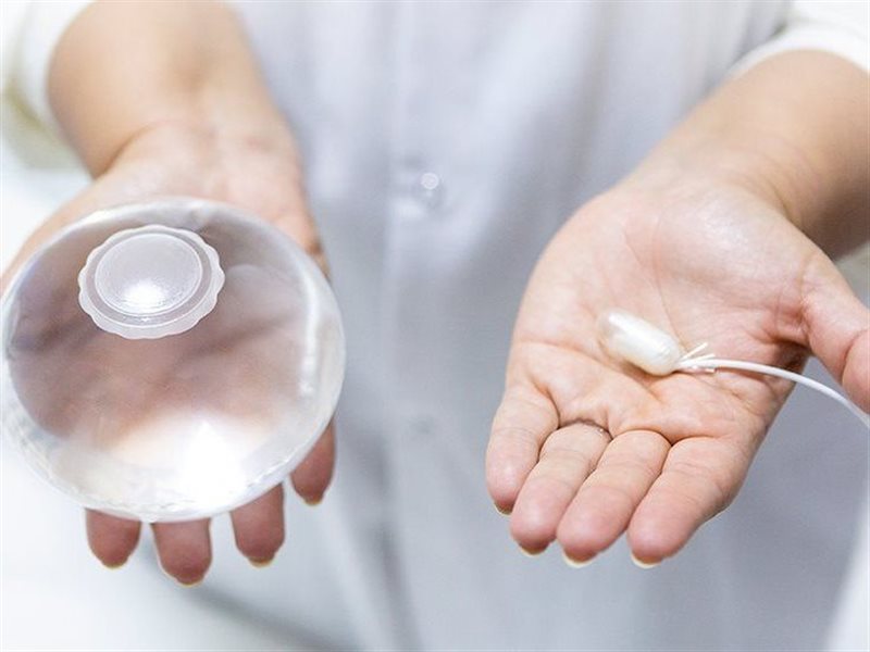 للتخلص من السمنة.. هل تغنيك الكبسولة الذكية عن تكميم المعدة؟  