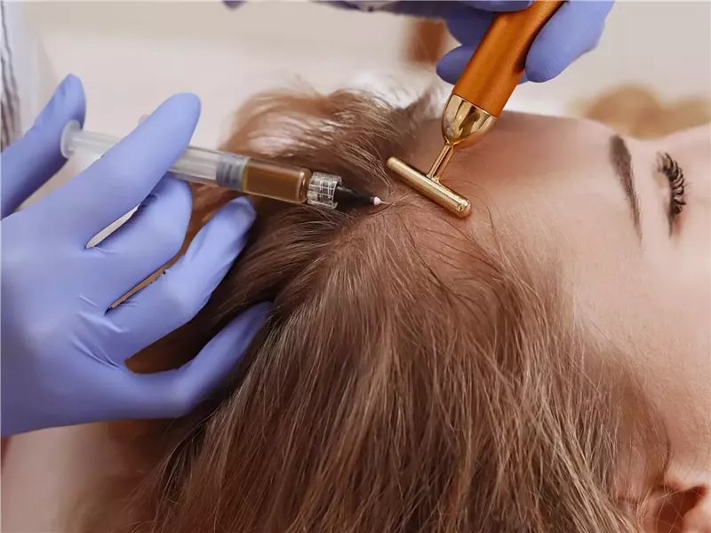 فوائد متعددة لجلسات الميزوثيرابي للشعر.. كيف يعمل؟ 