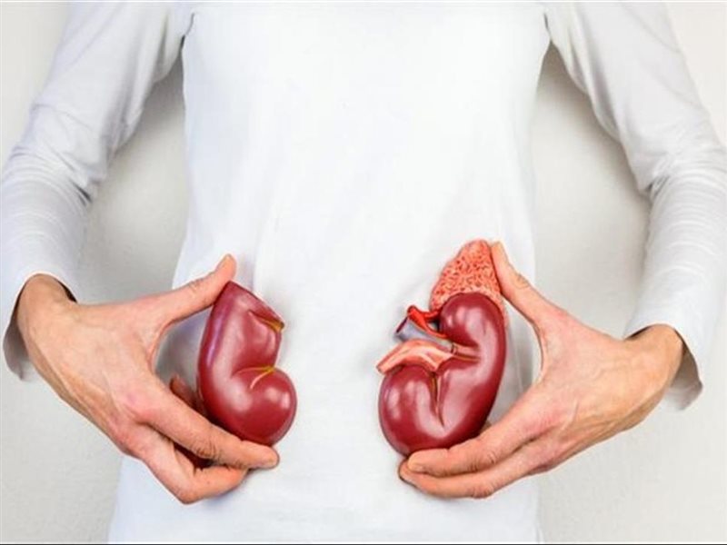 ما هي الأطعمة التي يجب الحد منها عند الإصابة بأمراض الكلى؟ 