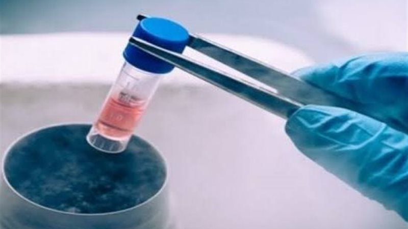 تجميد البويضات