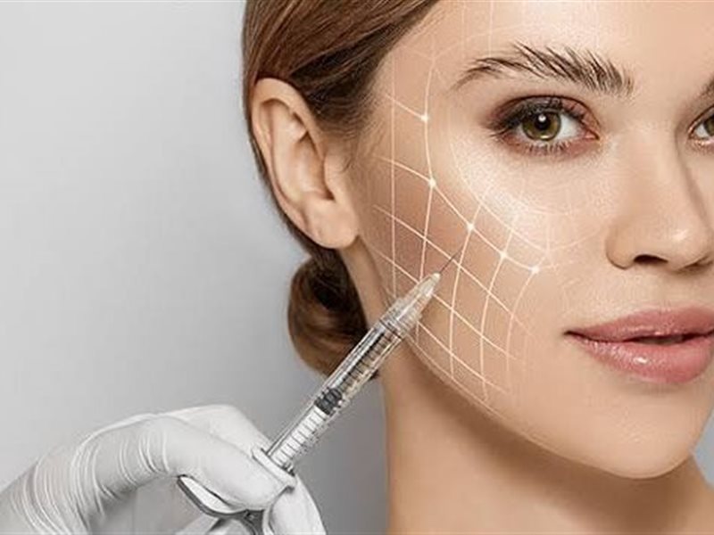 كل ما تحتاجين معرفته عن “البايو فيلر”: التقنية الجديدة التي تنافس الفيلر التقليدي 