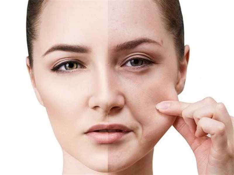 الثيرابي برايم.. تقنية غير جراحية لشد الوجه تغنيكِ عن الجراحة والألم