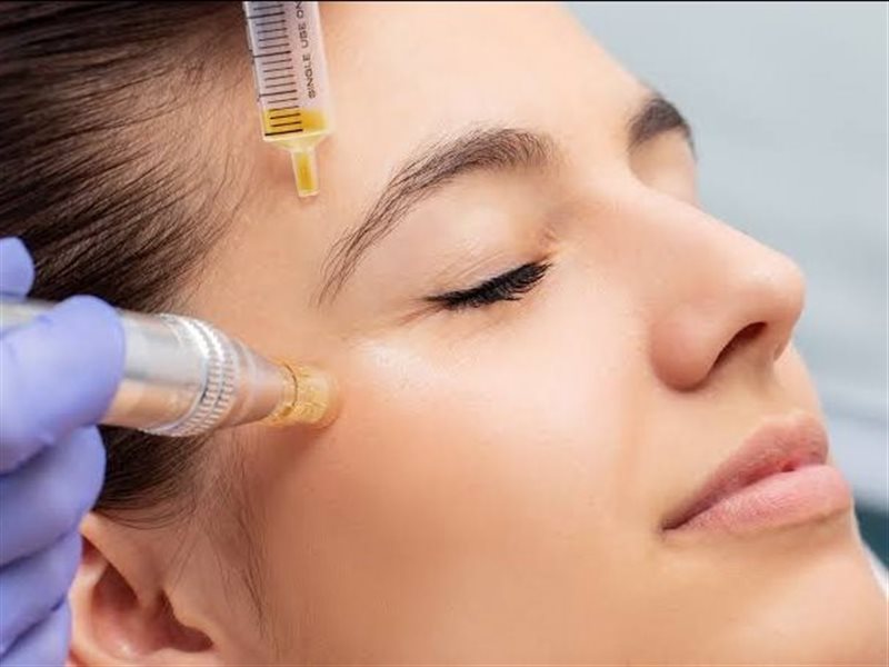  النانوفات.. تقنية تجميلية ثورية تعيد شباب البشرة بخلايا الجسم الذاتية