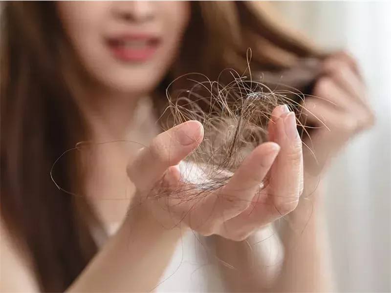 مشروب يستمتع به الملايين يوميًا قد يؤدي إلى تساقط الشعر 