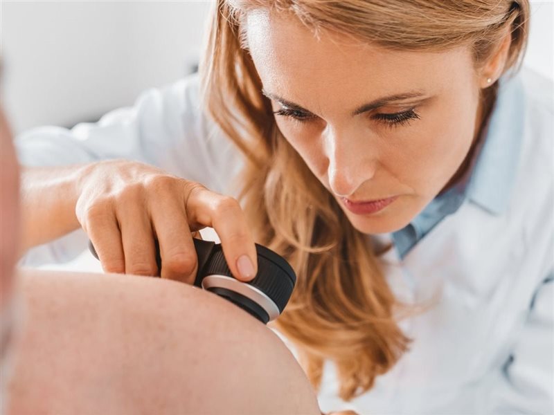 خبراء يكتشفون فيتامين بسيط قد يقلل من خطر الإصابة بسرطان الجلد 