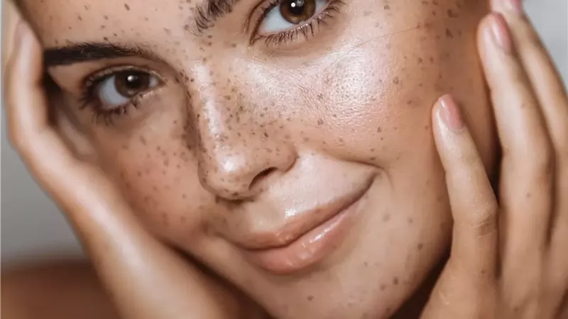  حمض اللاكتيك