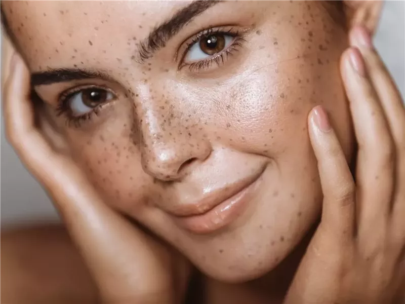  حمض اللاكتيك