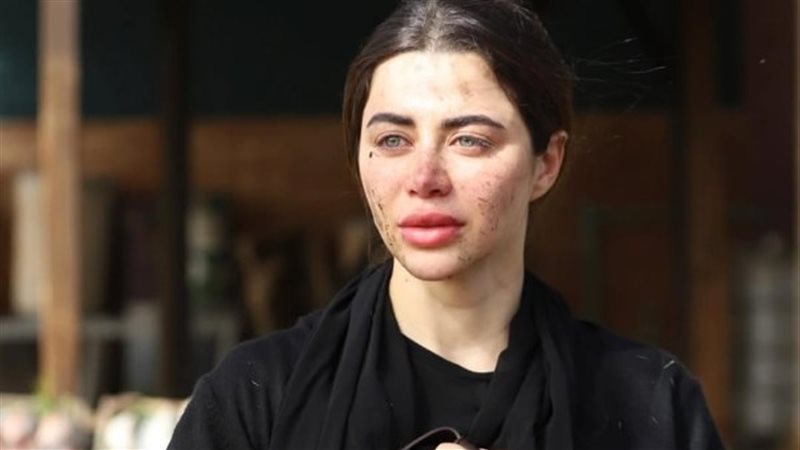 يارا السكري