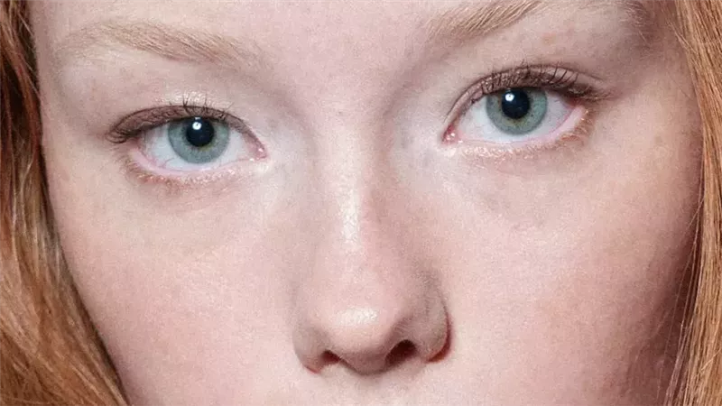 العيون المبطنة