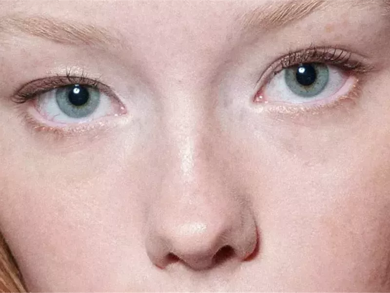 العيون المبطنة